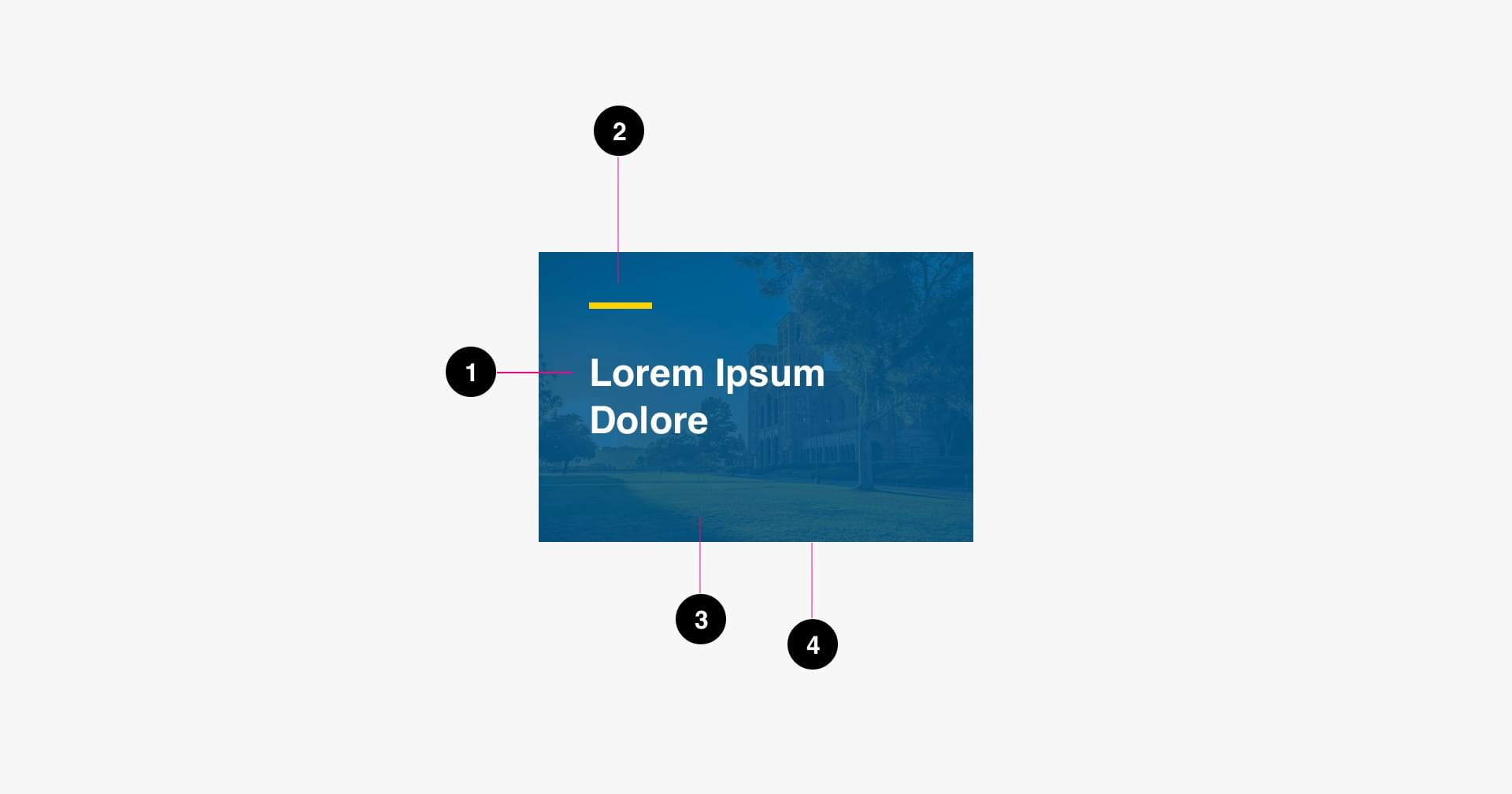 Basic Post Tiles Anatomy Image